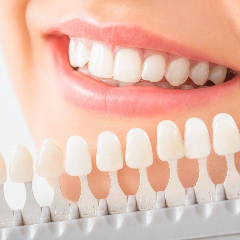 WHITENING CYCLE NI APA? APA BEZA 1,2&3 CYCLE?