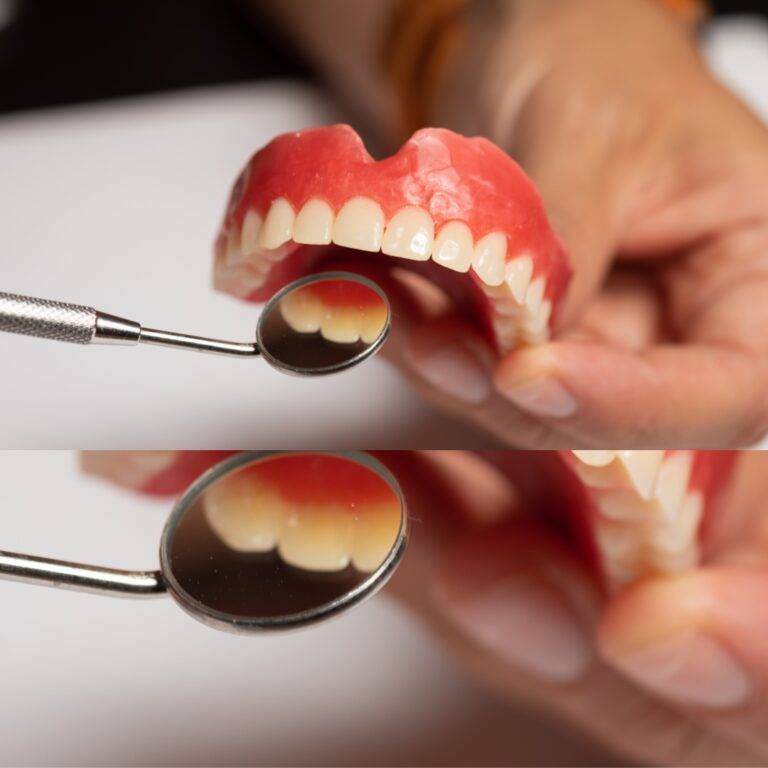 GIGI PALSU JADI LONGGAR? INI PUNCA & CARA ATASINYA