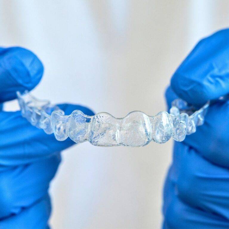 CLEAR ALIGNER NI APA? RAMAI PILIH SEBAB “TAK NAMPAK”