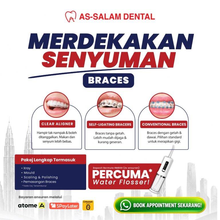 NAK PASANG BRACES? KENALI 3 PILIHAN BRACES DALAM KEMPEN MERDEKAKAN SENYUMAN!