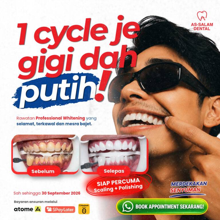 NAK GIGI PUTIH? JOM CUBA PROFESSIONAL WHITENING + FREE SCALING & POLISHING