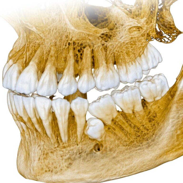 KENAPA 3D X-RAY PENTING??